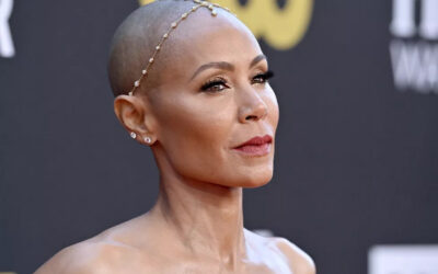 Caída del cabello: causas, síntomas y soluciones para la alopecia