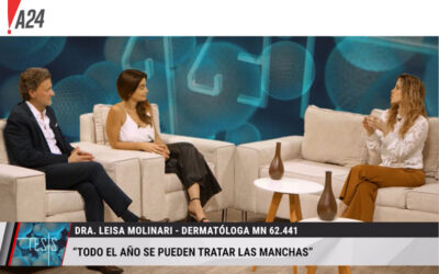 Todo el año se pueden tratar las Manchas de la piel