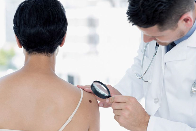 Prevención del Melanoma: concientización y cuidados para la piel