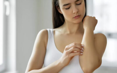 Psoriasis: abordaje y tratamiento efectivo