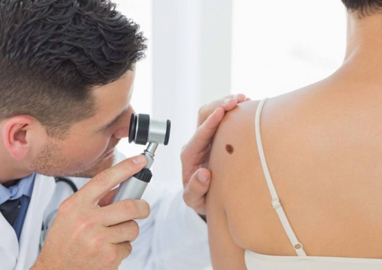 Día Mundial del Cáncer de Piel: qué hacer y cómo cuidarse tras el diagnóstico