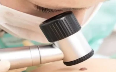 Día Mundial del Cáncer de Piel