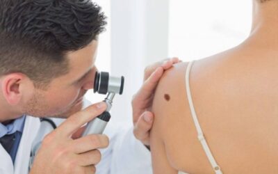 Día Mundial del Cáncer de Piel: qué hacer y cómo cuidarse tras el diagnóstico