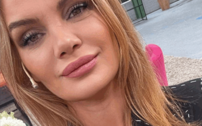 Eliana Guercio denunció mala praxis estética: qué tener en cuenta antes de un tratamiento facial