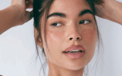 Tratamientos no invasivos: guía para saber qué es seguro y cuándo consultar al dermatólogo